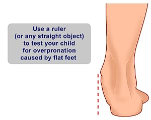 Overpronation kids hotsell